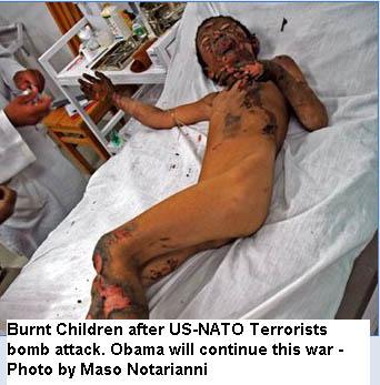 Anak Afghanistan setelah dibom teroris AS dan NATO